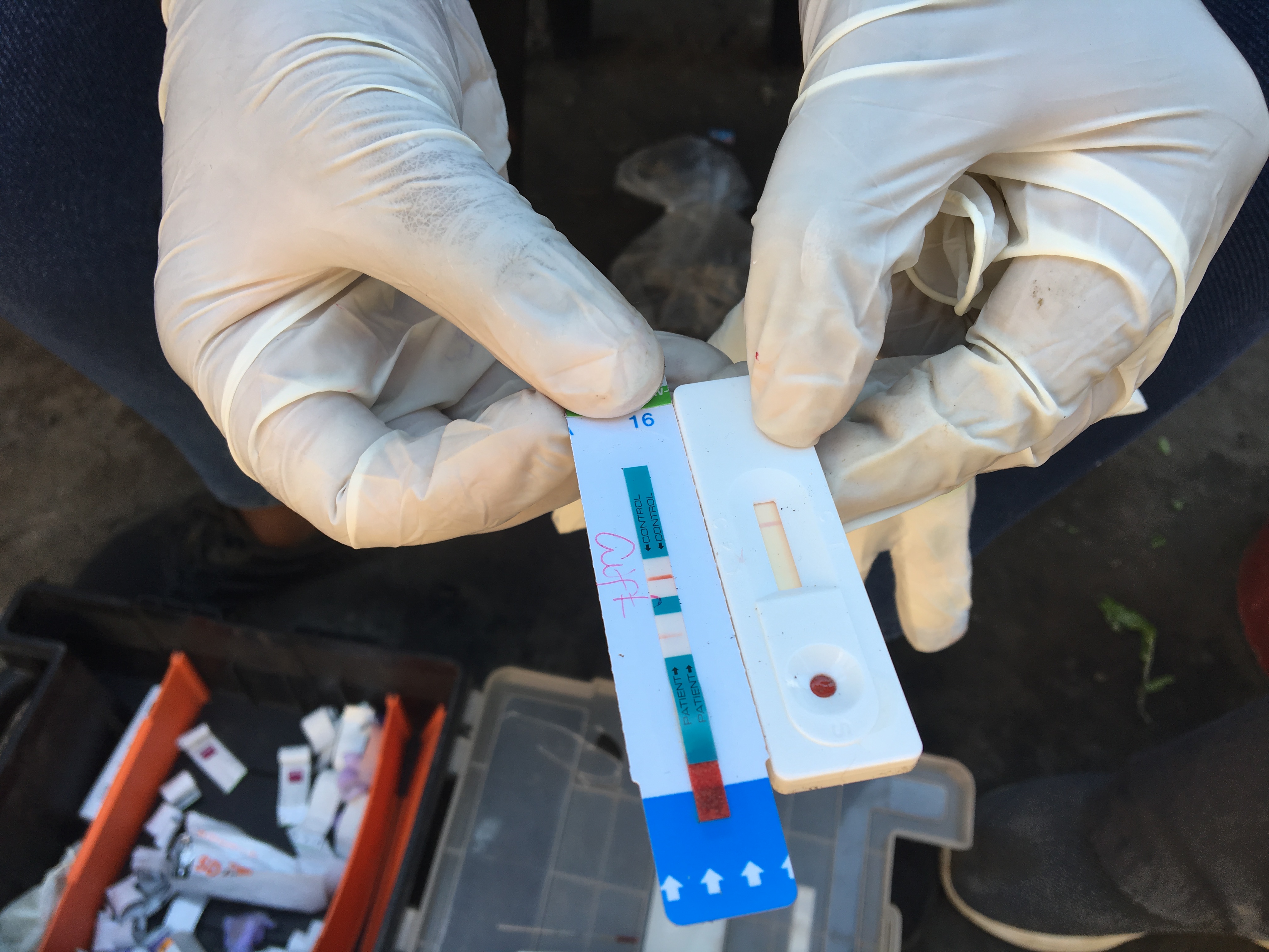 HIV test strips